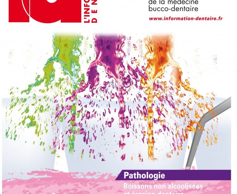 L'Information Dentaire n°43 - 11 décembre 2013
