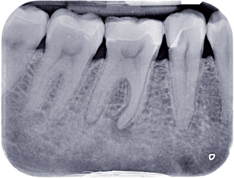 Le continuum endorestaurateur L
