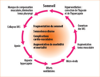 Syndrome d’apnées obstructives du sommeil de l’enfant : le rôle de l ...
