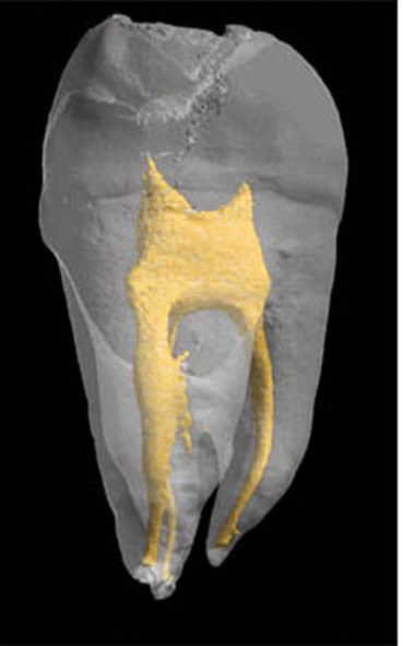 Des dents artificielles créées à partir de cellules souches - La DH/Les  Sports+