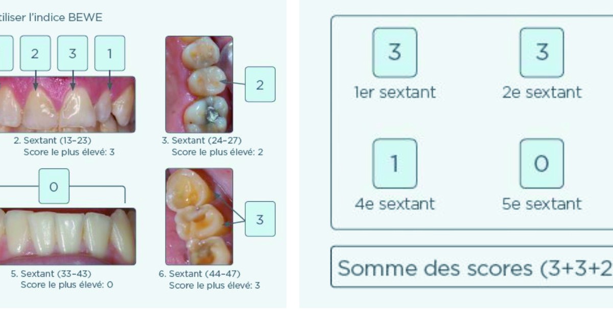 BEWE Assist – L'Information Dentaire
