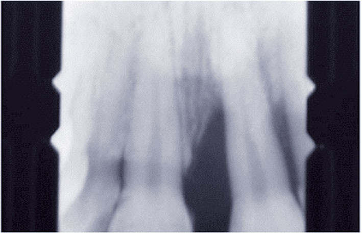 fig-3-a-abbassi.jpg