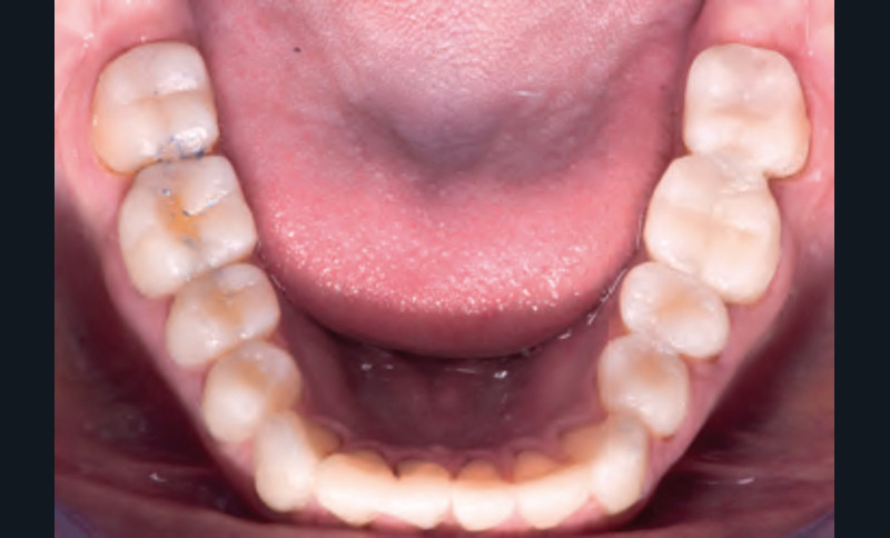 Guide sur la dentition et les troubles associés