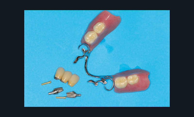Retour sur les conférences d’odonto-stomatologie – L'Information Dentaire