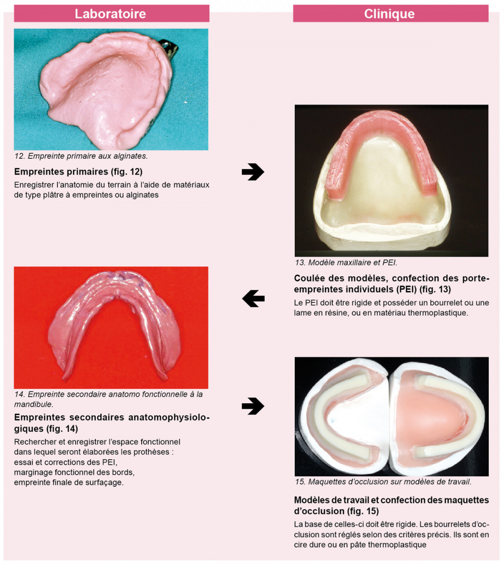 Macro Instantané De L'occlusion Dentaire, Des Dents Et Des Accolades En  Céramique Avec Des Bandes De Caoutchouc Colorées Dessus. Concept D'hygiène  Dentaire, De Dentisterie Et De Traitement Orthodontique. Banque D'Images et  Photos