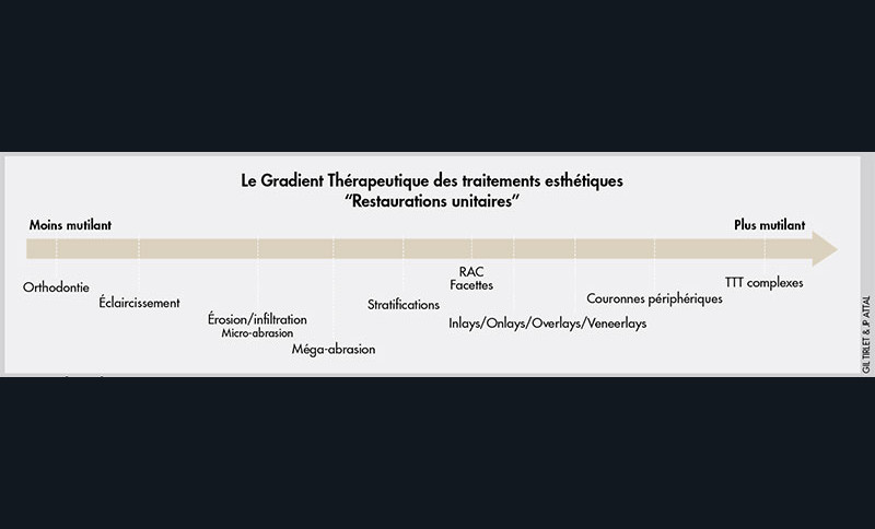 le-gradient-proth-tique-de-la-dent-unitaire-l-information-dentaire
