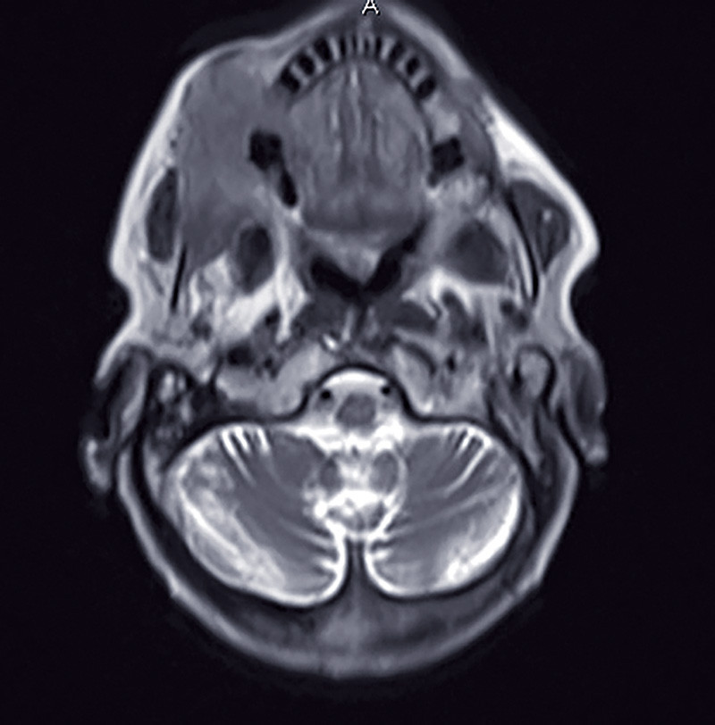 quiz-lesion-bourgeonnante2.jpg