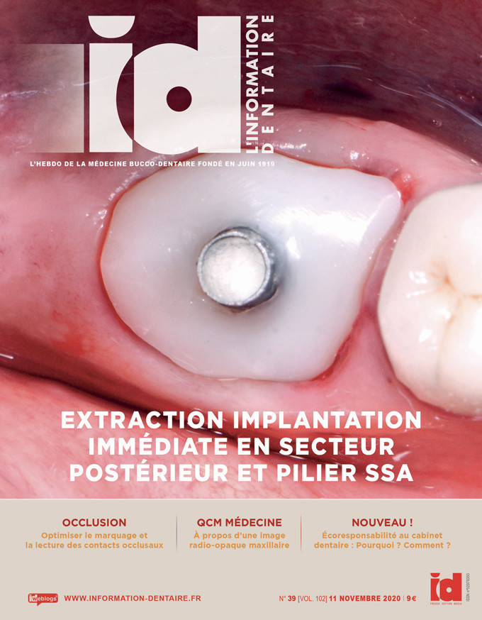 L'isolation dans le secteur antérieur – L'Information Dentaire