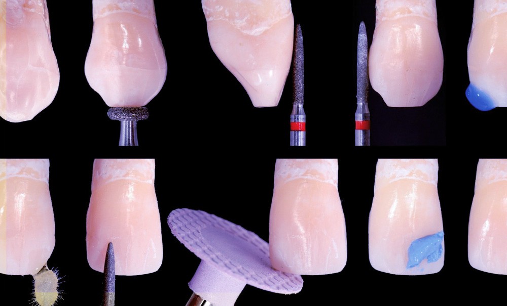 Applications Cliniques de l'Anatomie Incisive