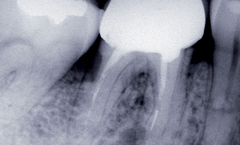 Ebook Endodontie volume traitements
