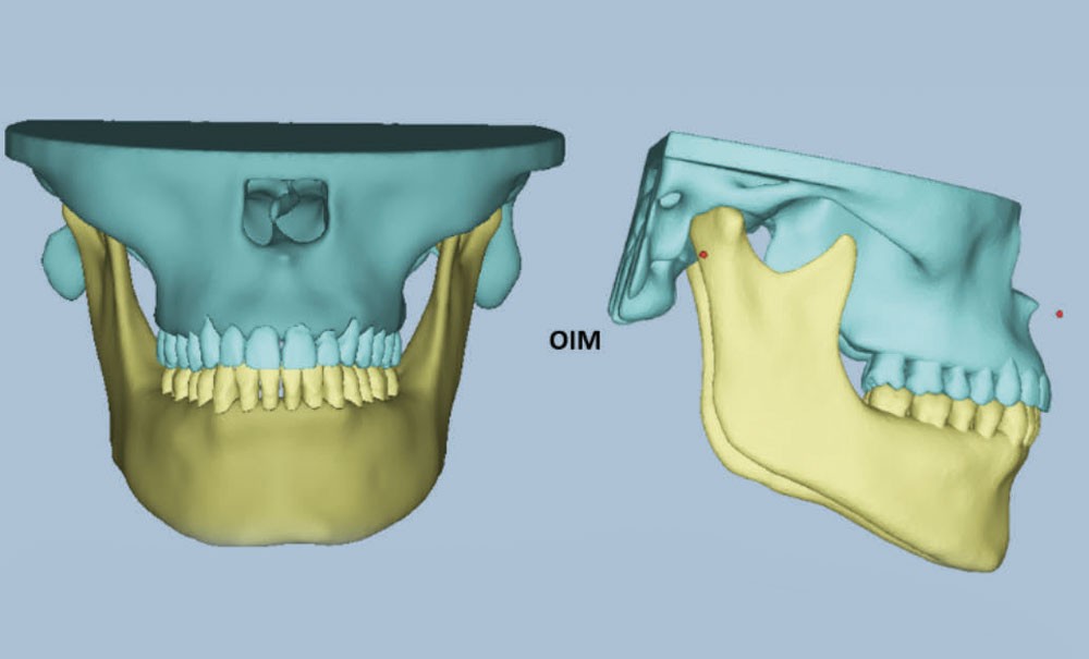 Nouveaux formats pédagogiques en occlusodontologie grâce à l’outil ...