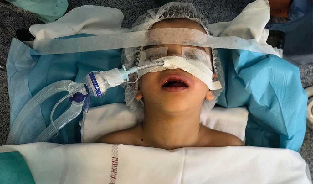 Accès aux soins dentaires sous anesthésie générale chez l’enfant dans les établissements publics Accès aux soins dentaires sous anesthésie générale chez l’enfant dans les établissements publics