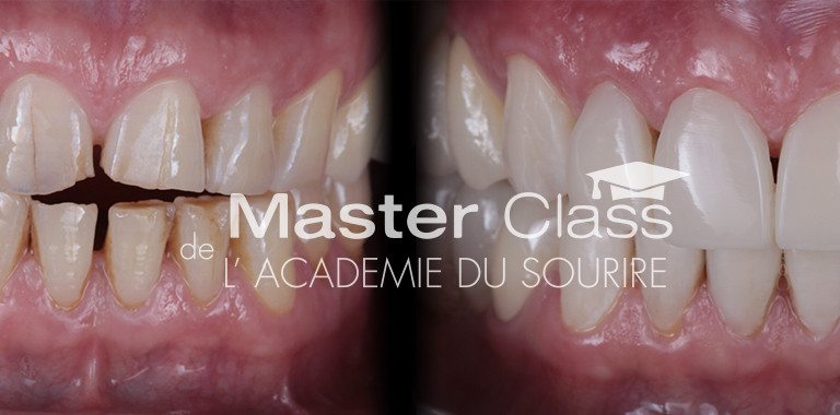 Composites injectés : l’esthétique à la portée de tous – L'Information ...