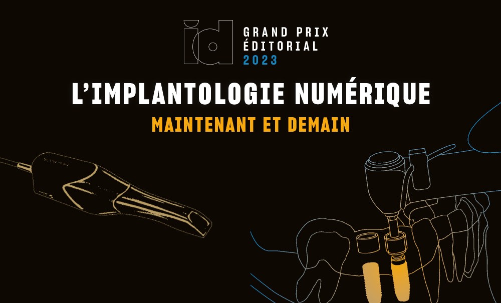 Grand prix éditorial de l’Id : L’implantologie numérique maintenant et ...