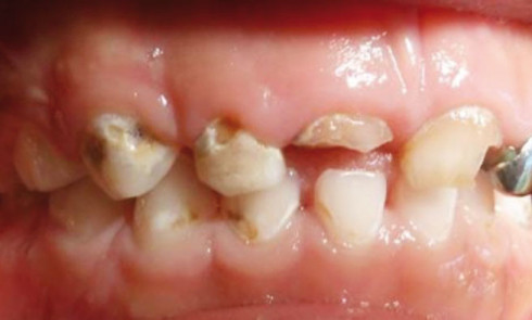 Des dents artificielles créées à partir de cellules souches - La DH/Les  Sports+