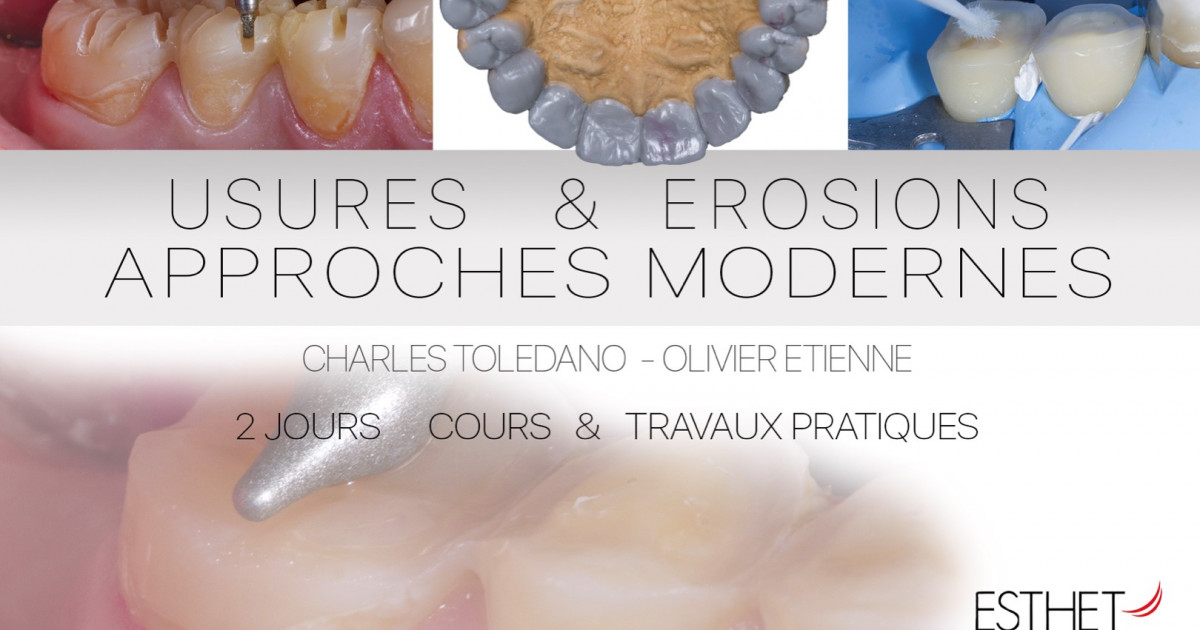 Le traitement de l’usure L'Information Dentaire