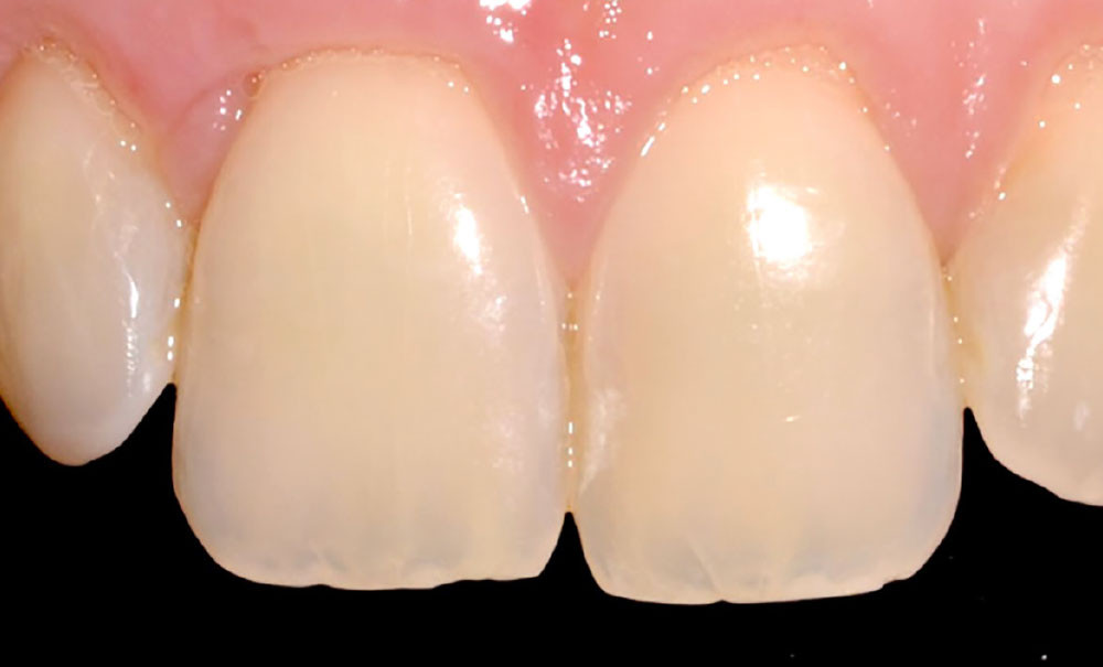 Nouvelle proposition pour une approche quantitative prévisionnelle du