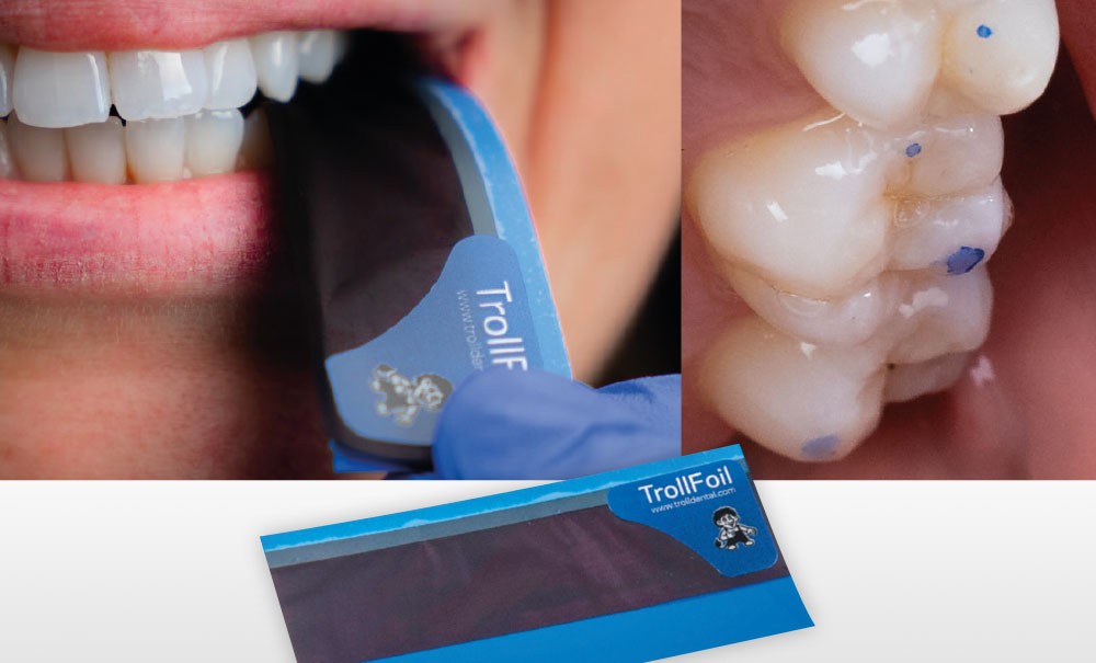 DIRECTA AB, TrollFoil blue – L'Information Dentaire