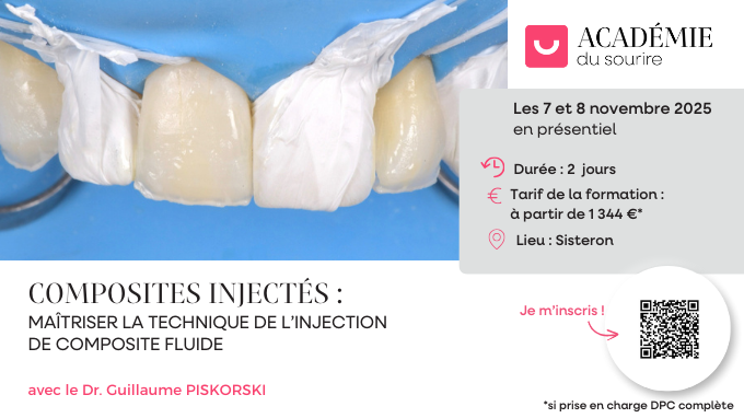 Composites injectés : maîtriser la technique de l’injection de ...