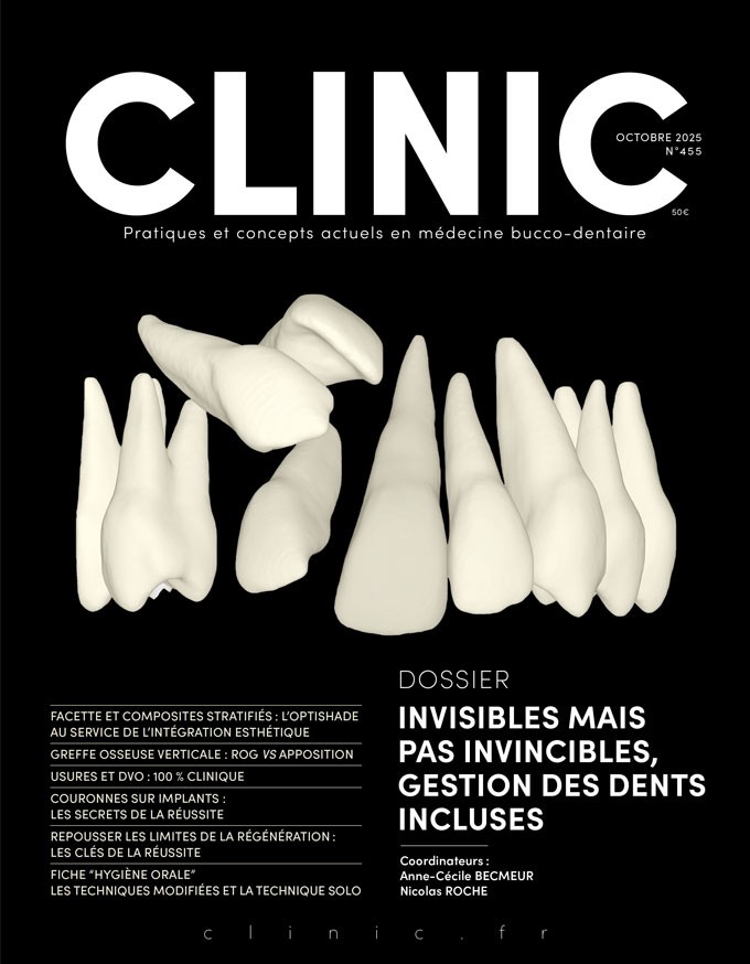 CLINIC - Octobre 2025 <br/> Dossier Gestion des dents incluses