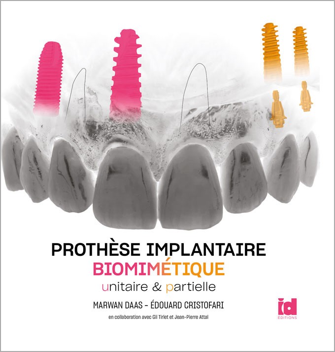 Prothèse implantaires biomimétique unitaire et partielle