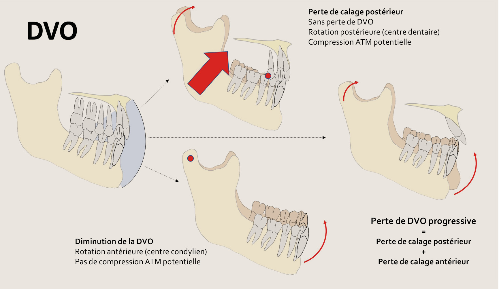 occlusion